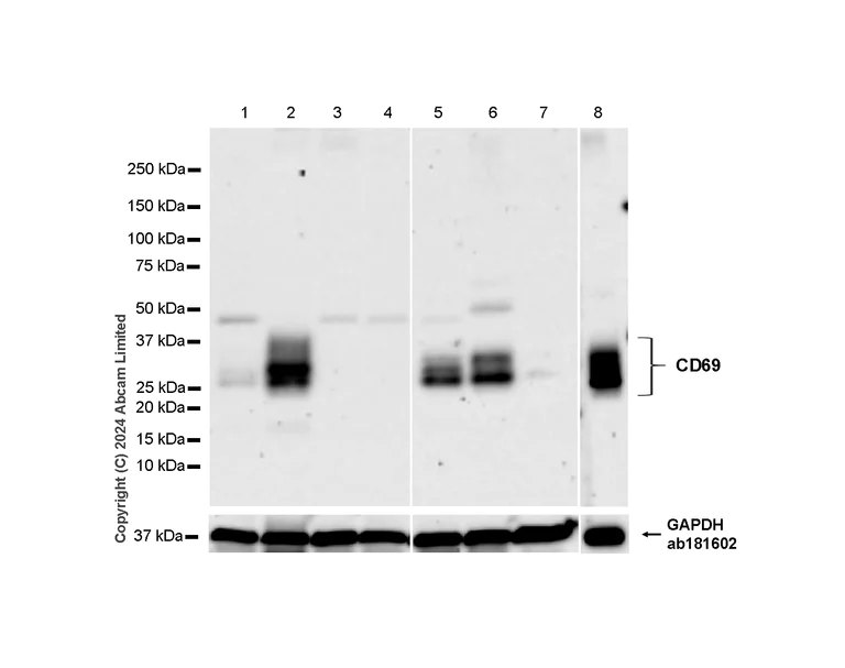 Western blot - Anti-CD69 antibody [RM1274] (AB322534)