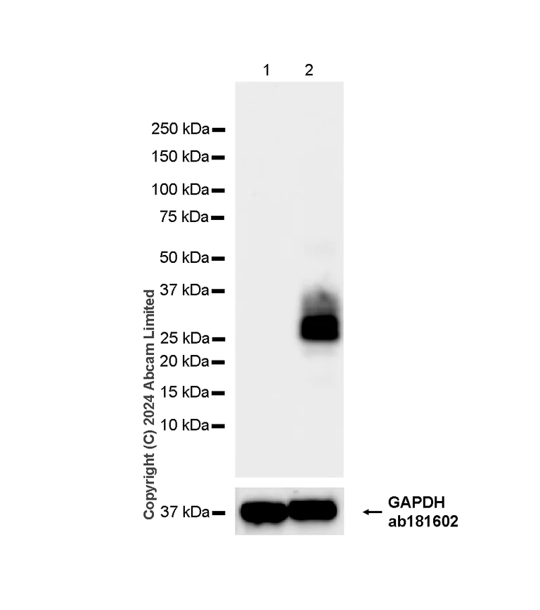 Western blot - Anti-CD69 antibody [RM1274] (AB322534)