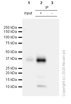 Immunoprecipitation - Anti-CD7 antibody [EPR4242] (AB109296), expandable thumbnail