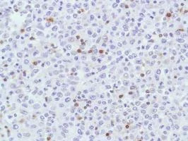 Immunohistochemistry (Formalin/PFA-fixed paraffin-embedded sections) - Anti-CD7 antibody [SP94] (AB183325)
