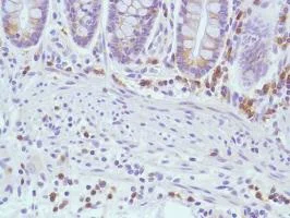Immunohistochemistry (Formalin/PFA-fixed paraffin-embedded sections) - Anti-CD7 antibody [SP94] (AB183325)