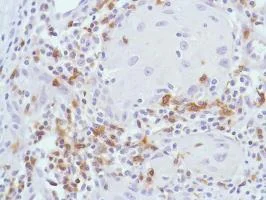 Immunohistochemistry (Formalin/PFA-fixed paraffin-embedded sections) - Anti-CD7 antibody [SP94] (AB183325)