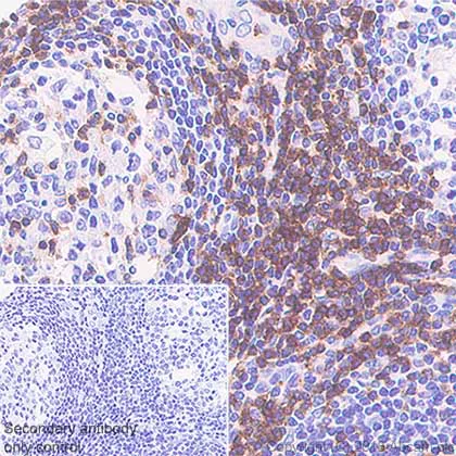 Immunohistochemistry (Formalin/PFA-fixed paraffin-embedded sections) - Anti-CD7 antibody [SP94] (AB183325)