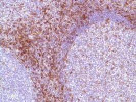 Immunohistochemistry (Formalin/PFA-fixed paraffin-embedded sections) - Anti-CD7 antibody [SP94] - BSA and Azide free (AB230904)