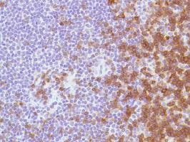 Immunohistochemistry (Formalin/PFA-fixed paraffin-embedded sections) - Anti-CD7 antibody [SP94] - BSA and Azide free (AB230904)