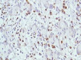 Immunohistochemistry (Formalin/PFA-fixed paraffin-embedded sections) - Anti-CD7 antibody [SP94] - BSA and Azide free (AB230904)