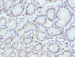 Immunohistochemistry (Formalin/PFA-fixed paraffin-embedded sections) - Anti-CD7 antibody [SP94] - BSA and Azide free (AB230904)