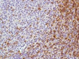 Immunohistochemistry (Formalin/PFA-fixed paraffin-embedded sections) - Anti-CD7 antibody [SP94] - BSA and Azide free (AB230904)