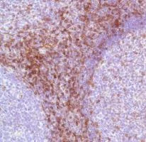 Immunohistochemistry (Formalin/PFA-fixed paraffin-embedded sections) - Anti-CD7 antibody [SP94] - BSA and Azide free (AB230904)