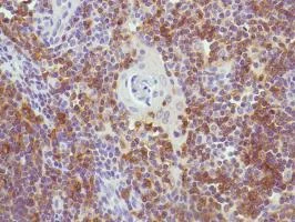 Immunohistochemistry (Formalin/PFA-fixed paraffin-embedded sections) - Anti-CD7 antibody [SP94] - BSA and Azide free (AB230904)