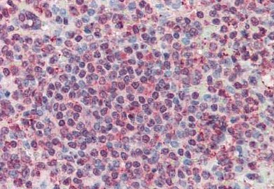Immunohistochemistry (Formalin/PFA-fixed paraffin-embedded sections) - Anti-CD70 antibody (AB133398), expandable thumbnail