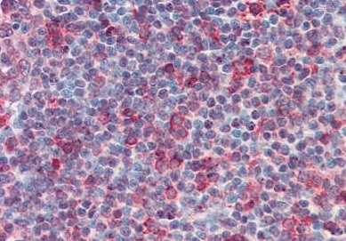Immunohistochemistry (Formalin/PFA-fixed paraffin-embedded sections) - Anti-CD70 antibody (AB133398), expandable thumbnail