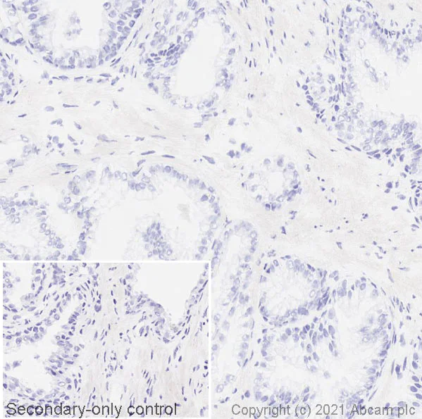 Immunohistochemistry (Frozen sections) - Anti-CD70 antibody [BU69] (AB77868)