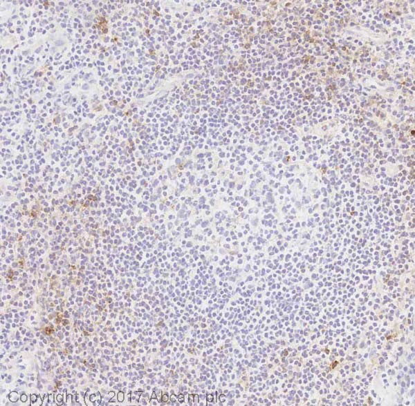 Immunohistochemistry (Frozen sections) - Anti-CD70 antibody [BU69] (AB77868)