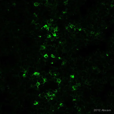 Immunohistochemistry (Frozen sections) - Anti-CD70 antibody [BU69] (AB77868)