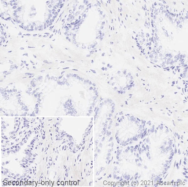 Immunohistochemistry (Frozen sections) - Anti-CD70 antibody [BU69] - BSA and Azide free (AB269573)