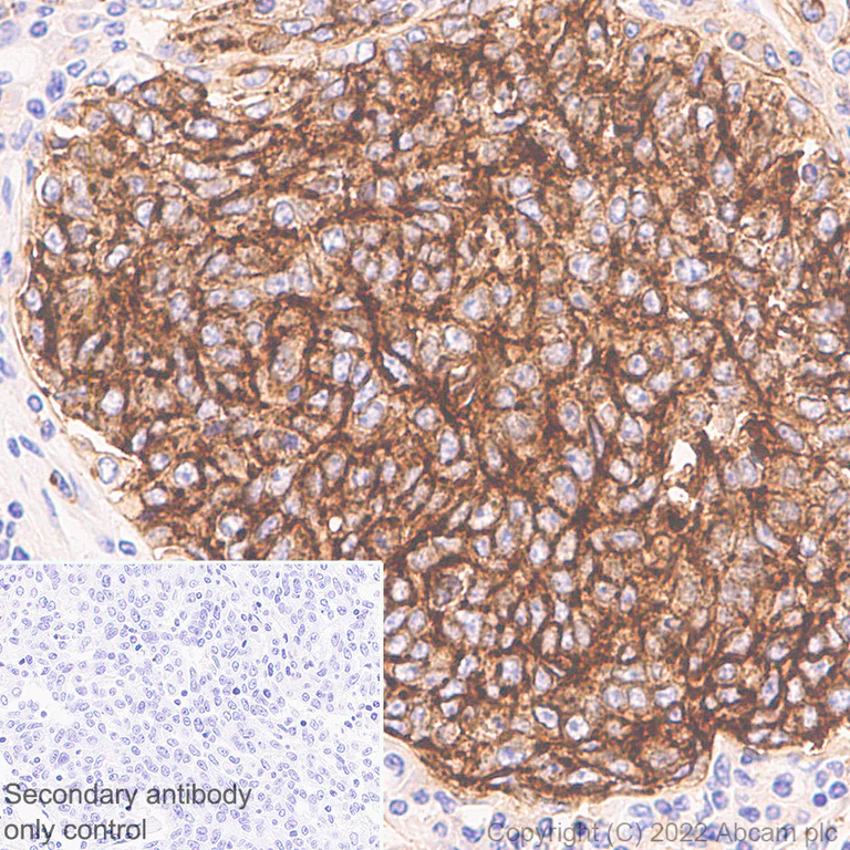 Immunohistochemistry (Formalin/PFA-fixed paraffin-embedded sections) - Anti-CD70 antibody [EPR26536-122] (AB300083)