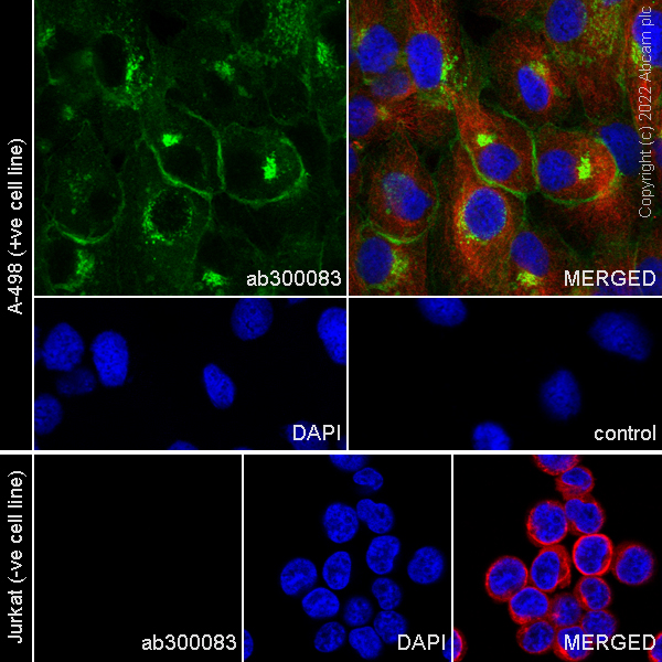 Immunocytochemistry/ Immunofluorescence - Anti-CD70 antibody [EPR26536-122] (BSA and Azide free) (ab300084), expandable thumbnail