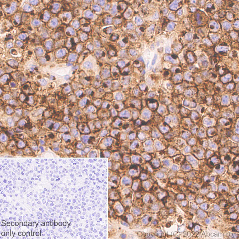 Immunohistochemistry (Formalin/PFA-fixed paraffin-embedded sections) - Anti-CD70 antibody [EPR26536-122] (BSA and Azide free) (AB300084)