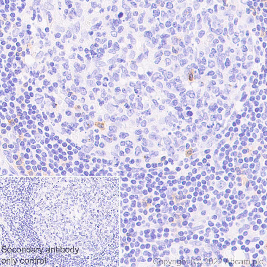 Immunohistochemistry (Formalin/PFA-fixed paraffin-embedded sections) - Anti-CD70 antibody [EPR26536-122] (BSA and Azide free) (AB300084), expandable thumbnail