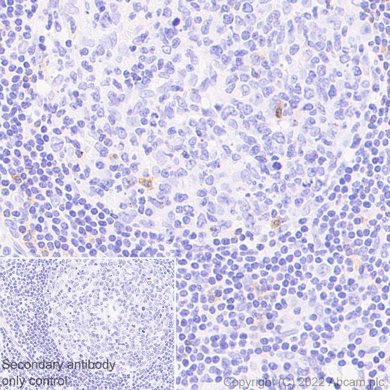 Immunohistochemistry (Formalin/PFA-fixed paraffin-embedded sections) - Anti-CD70 antibody [EPR26536-122] (BSA and Azide free) (AB300084)
