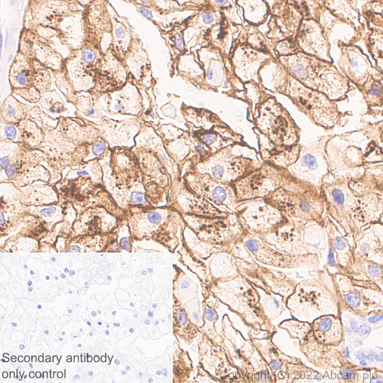 Immunohistochemistry (Formalin/PFA-fixed paraffin-embedded sections) - Anti-CD70 antibody [EPR26536-122] (BSA and Azide free) (AB300084)