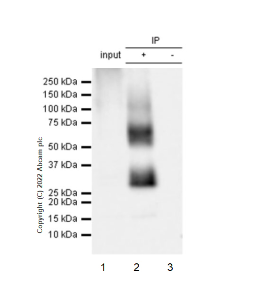 Immunoprecipitation - Anti-CD70 antibody [EPR26536-122] (BSA and Azide free) (ab300084), expandable thumbnail