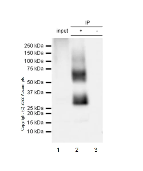 Immunoprecipitation - Anti-CD70 antibody [EPR26536-122] (BSA and Azide free) (AB300084)