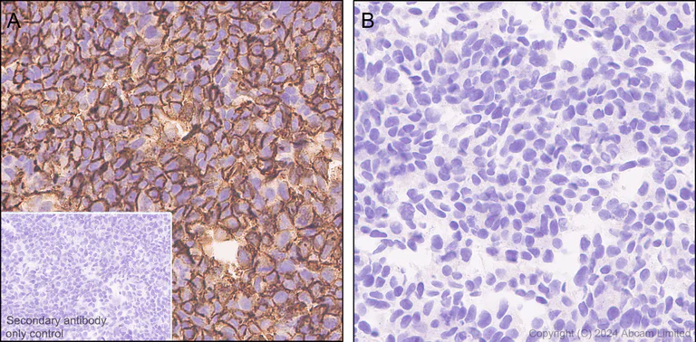 Immunohistochemistry (Formalin/PFA-fixed paraffin-embedded sections) - Anti-CD70 antibody [EPR28771-94] (AB319990)