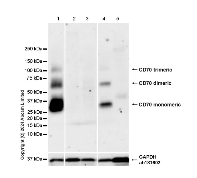 Western blot - Anti-CD70 antibody [EPR28771-94] (AB319990)