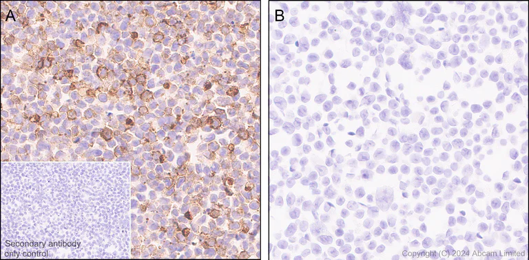 Immunohistochemistry (Formalin/PFA-fixed paraffin-embedded sections) - Anti-CD70 antibody [EPR28771-94] - BSA and Azide free (AB319991)