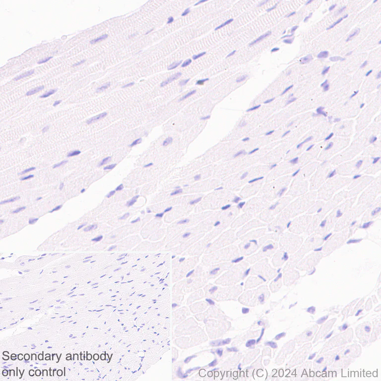 Immunohistochemistry (Formalin/PFA-fixed paraffin-embedded sections) - Anti-CD70 antibody [EPR28771-94] - BSA and Azide free (AB319991)