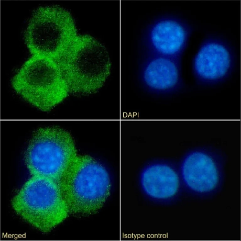 Immunocytochemistry/ Immunofluorescence - Anti-CD70 antibody [TAN1-6] (AB281908)