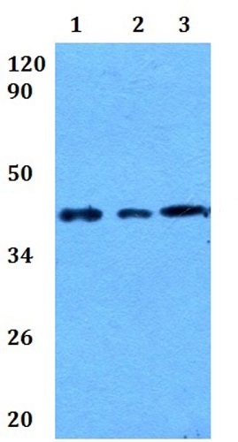 Western blot - Anti-CD72 antibody (AB201079), expandable thumbnail