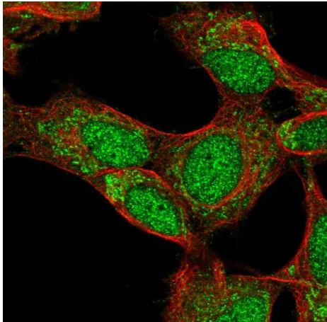 Immunocytochemistry/ Immunofluorescence - Anti-CD72 antibody (AB204336)