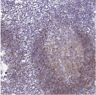 Immunohistochemistry (Formalin/PFA-fixed paraffin-embedded sections) - Anti-CD72 antibody (AB204336)