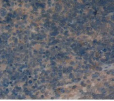 Immunohistochemistry (Formalin/PFA-fixed paraffin-embedded sections) - Anti-CD72 antibody (AB231106)