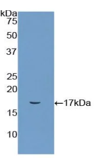 Western blot - Anti-CD72 antibody (AB231106)