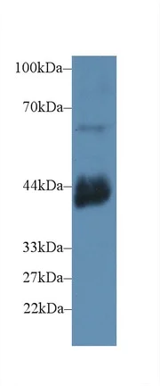 Western blot - Anti-CD72 antibody (AB231106)