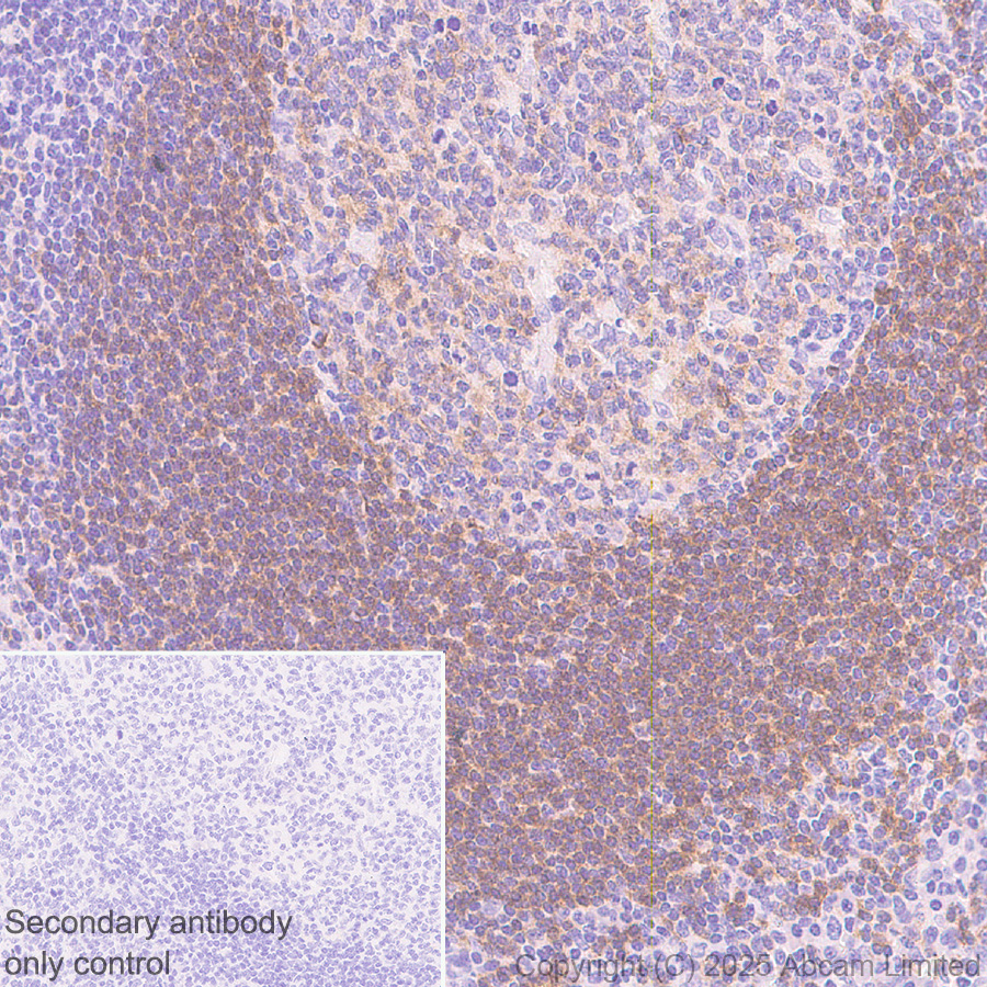 Immunohistochemistry (Formalin/PFA-fixed paraffin-embedded sections) - Anti-CD72 antibody [EPR29739-578] (AB324351), expandable thumbnail