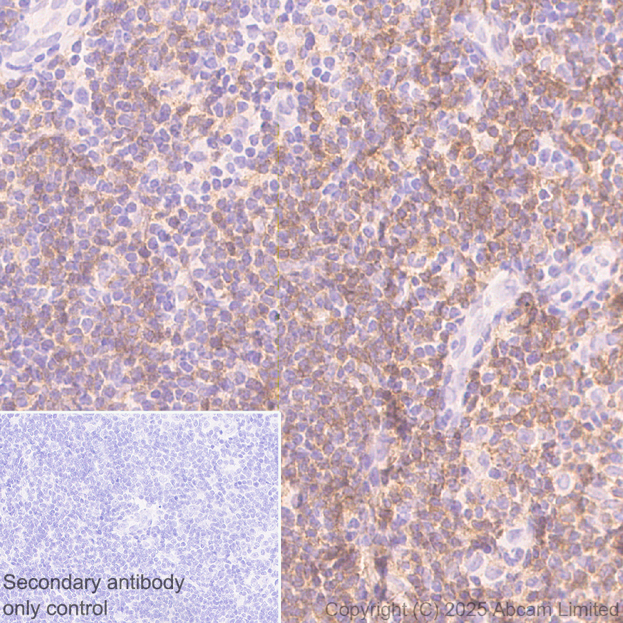 Immunohistochemistry (Formalin/PFA-fixed paraffin-embedded sections) - Anti-CD72 antibody [EPR29739-578] (AB324351), expandable thumbnail