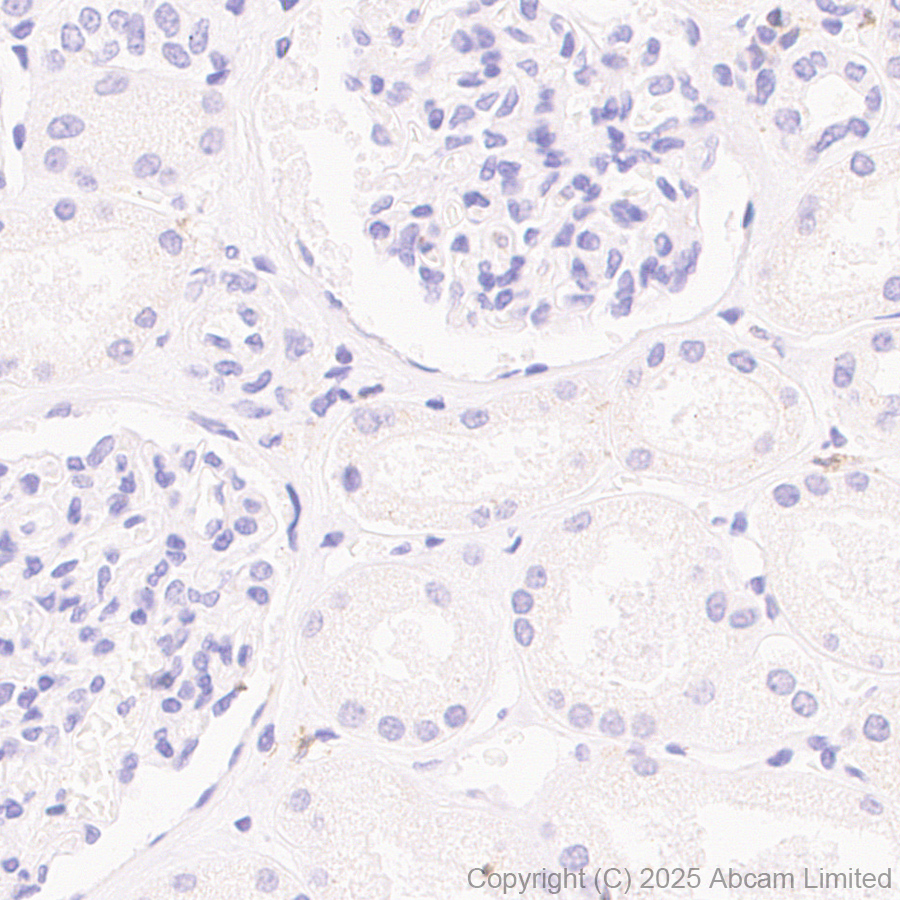 Immunohistochemistry (Formalin/PFA-fixed paraffin-embedded sections) - Anti-CD72 antibody [EPR29739-578] (AB324351), expandable thumbnail