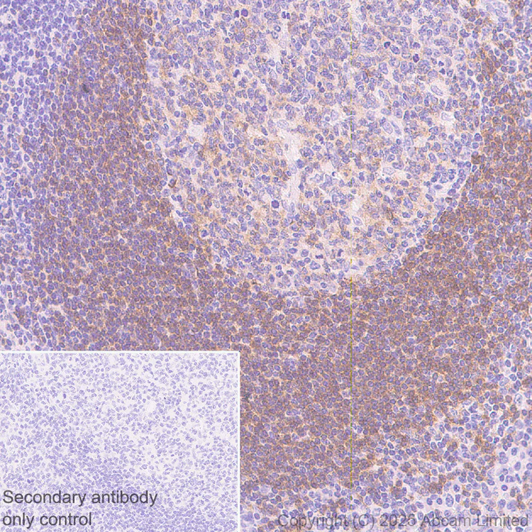 Immunohistochemistry (Formalin/PFA-fixed paraffin-embedded sections) - Anti-CD72 antibody [EPR29739-578] - BSA and Azide free (AB324360)