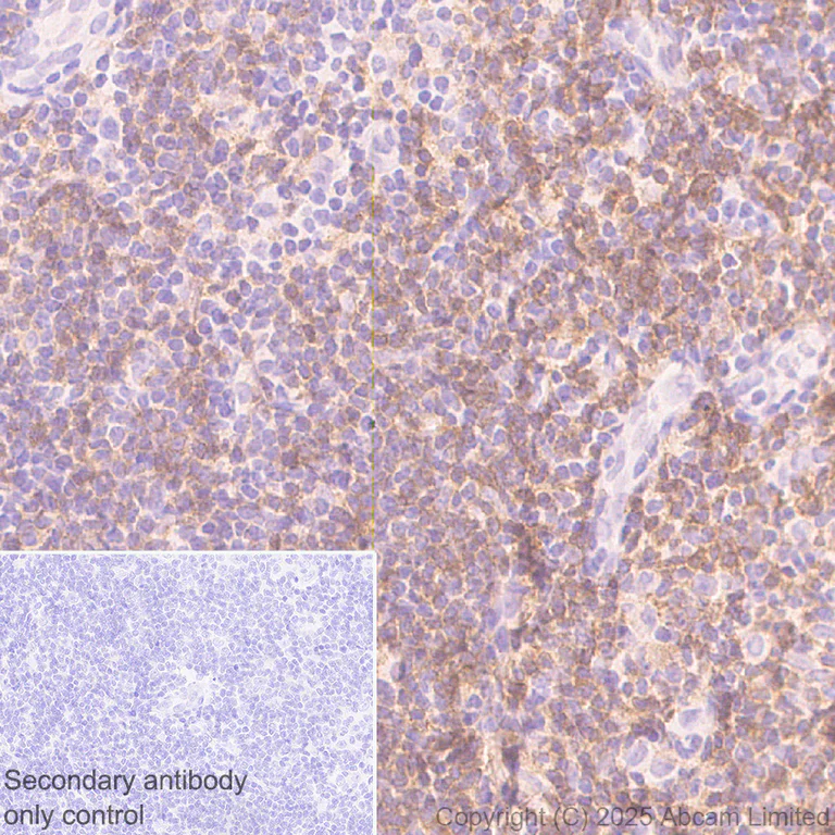Immunohistochemistry (Formalin/PFA-fixed paraffin-embedded sections) - Anti-CD72 antibody [EPR29739-578] - BSA and Azide free (AB324360)