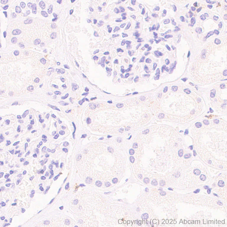 Immunohistochemistry (Formalin/PFA-fixed paraffin-embedded sections) - Anti-CD72 antibody [EPR29739-578] - BSA and Azide free (AB324360)