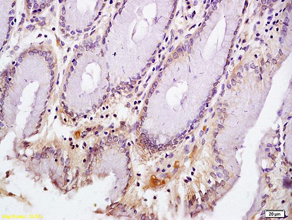 Immunohistochemistry (Formalin/PFA-fixed paraffin-embedded sections) - Anti-CD72 antibody - N-terminal (AB202843), expandable thumbnail