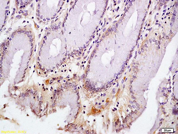 Immunohistochemistry (Formalin/PFA-fixed paraffin-embedded sections) - Anti-CD72 antibody - N-terminal (AB202843)