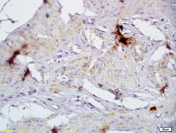Immunohistochemistry (Formalin/PFA-fixed paraffin-embedded sections) - Anti-CD72 antibody - N-terminal (AB202843), expandable thumbnail