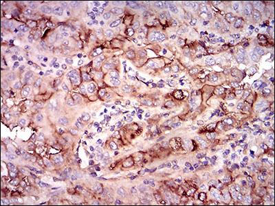 Immunohistochemistry (Formalin/PFA-fixed paraffin-embedded sections) - Anti-CD73 antibody [4G6E3] (ab202122), expandable thumbnail