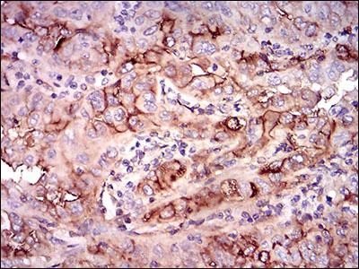Immunohistochemistry (Formalin/PFA-fixed paraffin-embedded sections) - Anti-CD73 antibody [4G6E3] (AB202122)